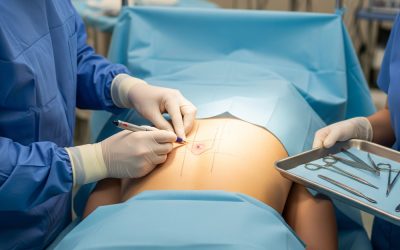 Understanding Skin Cancer Removal: Procedures Available in Northern Kentucky…