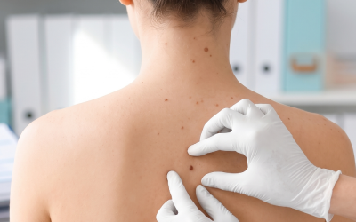 How Often Should You Get a Full-Body Skin Exam? What Northern Kentucky Dermatologists Want You to Know…